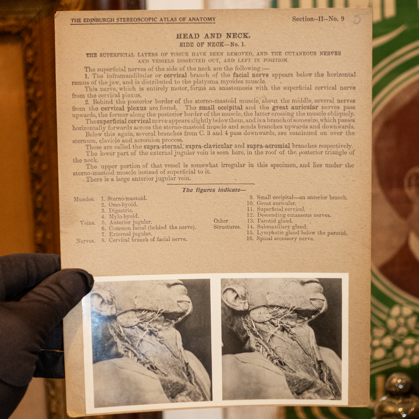 Vintage Medical Stereo View