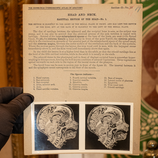 Vintage Medical Stereo View