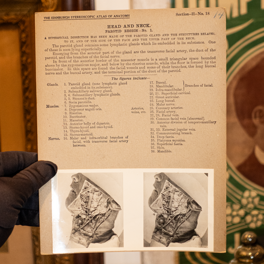 Vintage Medical Stereo View