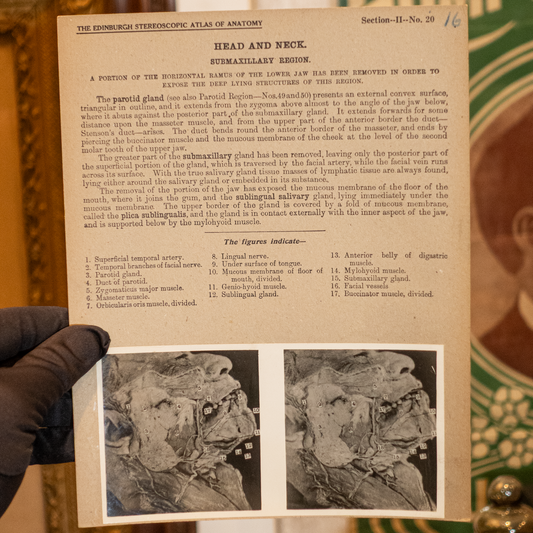 Vintage Medical Stereo View