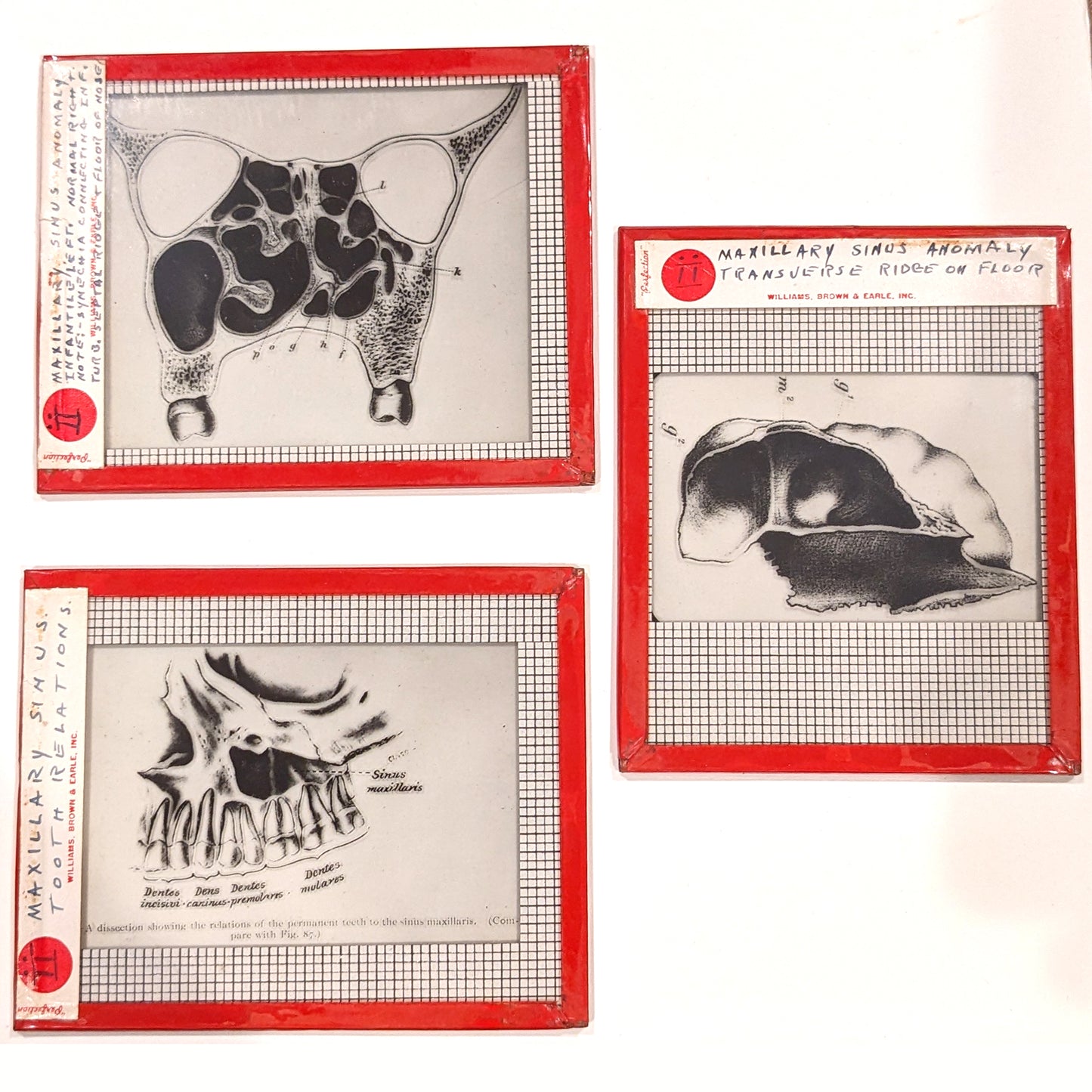 University Of Pennsylvania Medical Glass Slide Collection