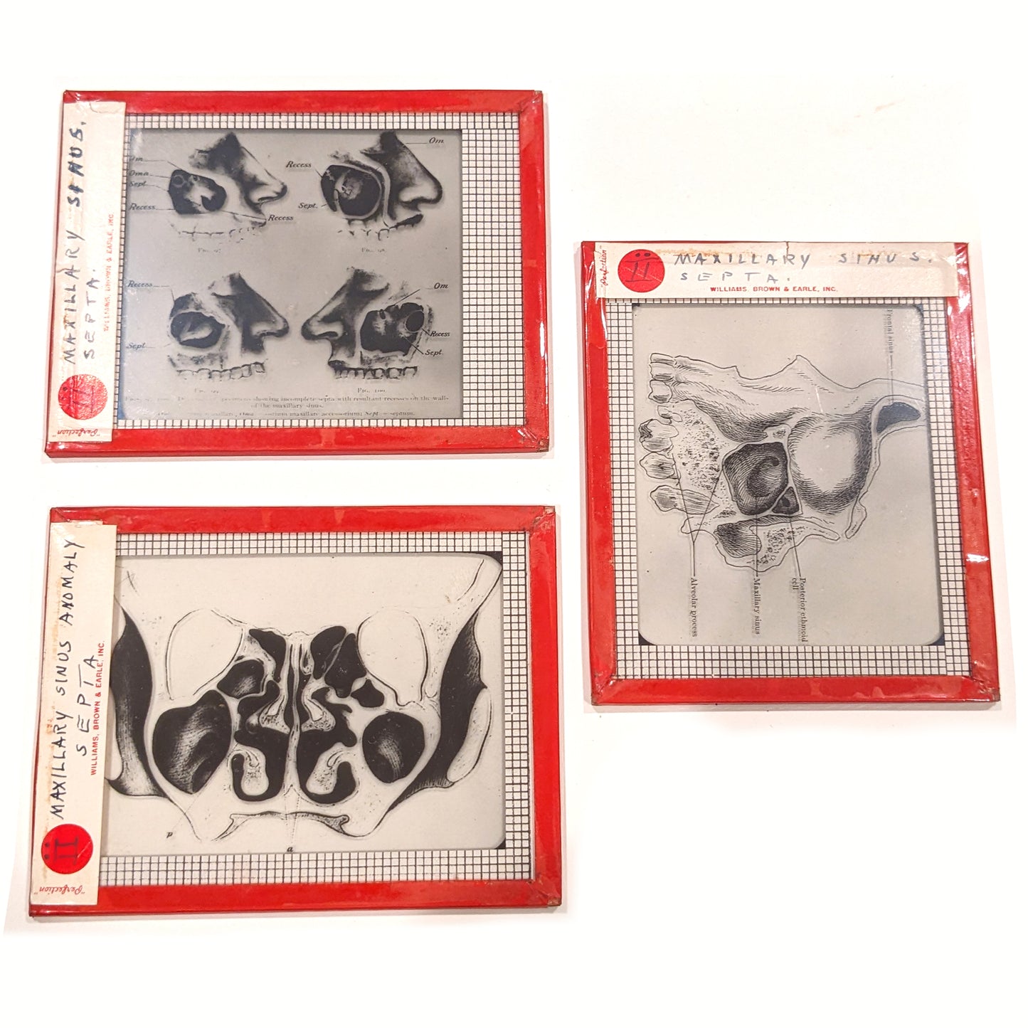 University Of Pennsylvania Medical Glass Slide Collection